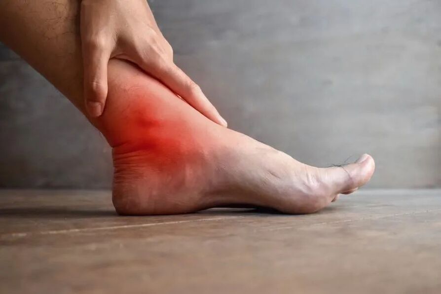 artroza e kyçit të kyçit të këmbës