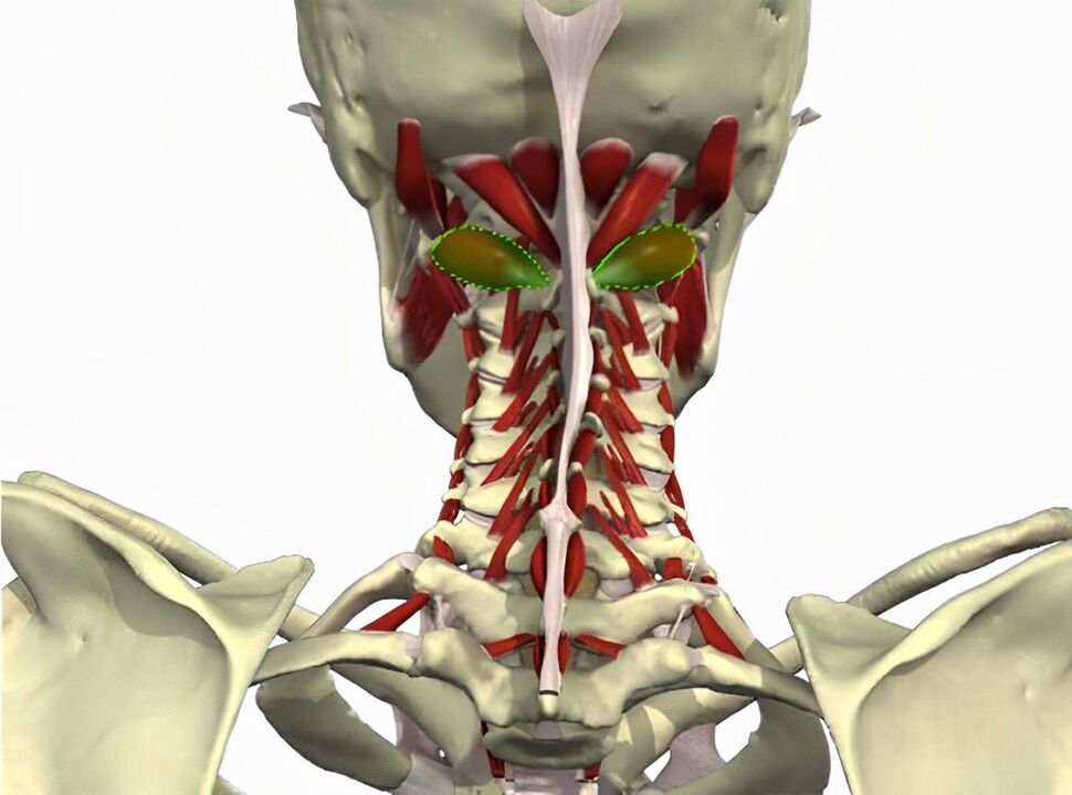 sindromi i arteries vertebrale